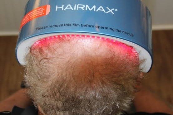 HairMax: How the LaserBand 82 ComfortFlex Treats Thinning Hair in 90 Seconds - photo 2